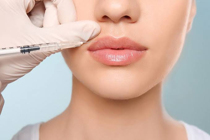 Clinician injecting dermal filler into a client's lips.